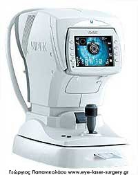 khuc-xa-ke-AR-310A.jpg