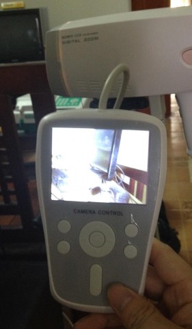 Máy nội soi cổ tử cung KTS HT-01