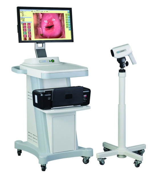 Máy soi cổ tử cung LT 300 - Lutech