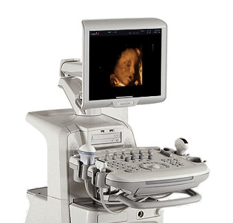 MÁY SIÊU ÂM MEDISON SONOACE X8