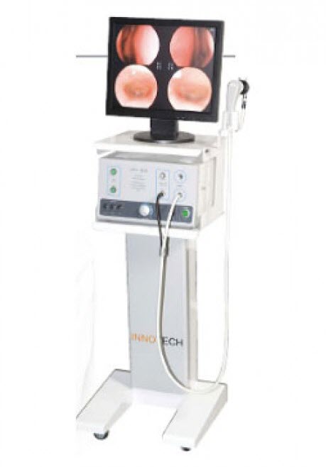 Máy nội soi Tai mũi họng INV-250 Inotech chính hãng Hàn Quốc